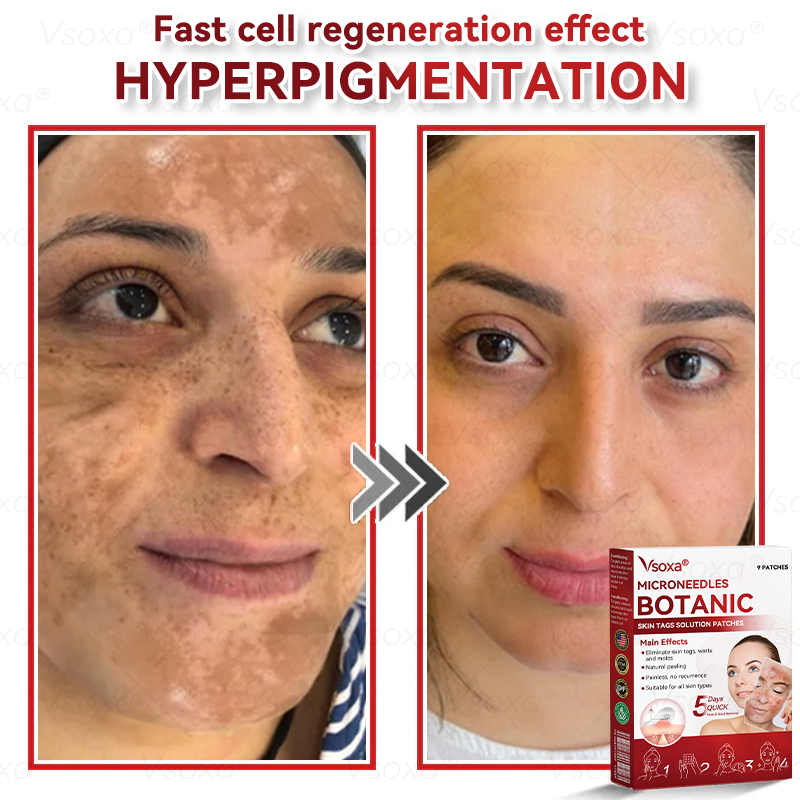 🔥 Dernière place disponible ! ⚡ Profitez de 30 % de réduction — offre limitée !𝑉𝑠𝑜𝑥𝑎® 𝑀𝑖𝑐𝑟𝑜-𝑎𝑖𝑔𝑢𝑖𝑙𝑙𝑒𝑠 𝐵𝑜𝑡𝑎𝑛𝑖𝑞𝑢𝑒 𝑃𝑒𝑎𝑢 É𝑡𝑖𝑞𝑢𝑒𝑡𝑡𝑒𝑠 𝑆𝑜𝑙𝑢𝑡𝑖𝑜𝑛 𝑃𝑎𝑡𝑐ℎ𝑠-𝐹𝑎𝑏𝑟𝑖𝑞𝑢é 𝑒𝑛 𝐹𝑟𝑎𝑛𝑐𝑒